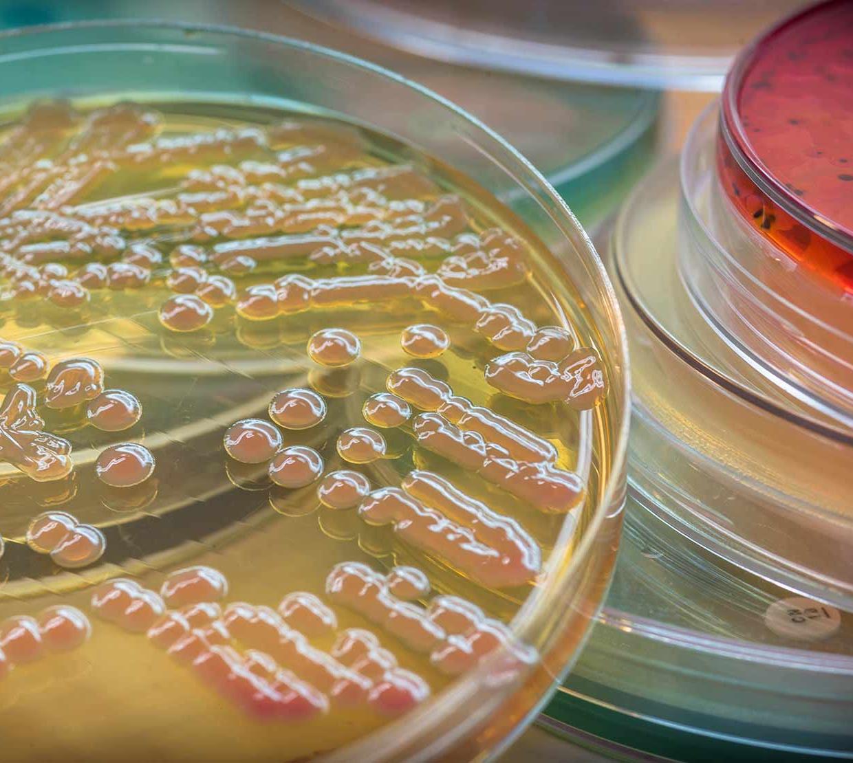 bacteria in pile of Petri dishes