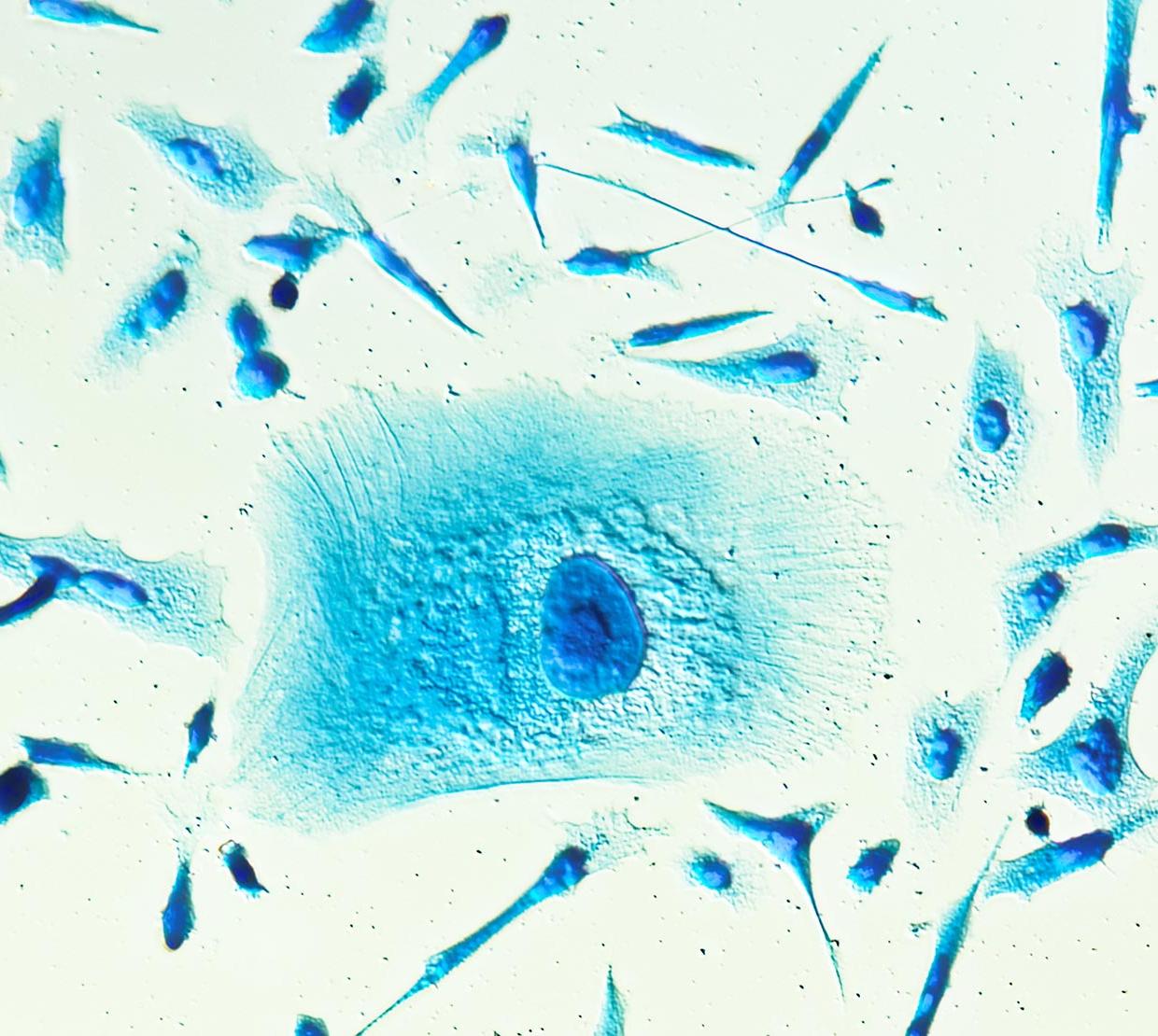 microscopic image of blue PC-3 cancer cells 
