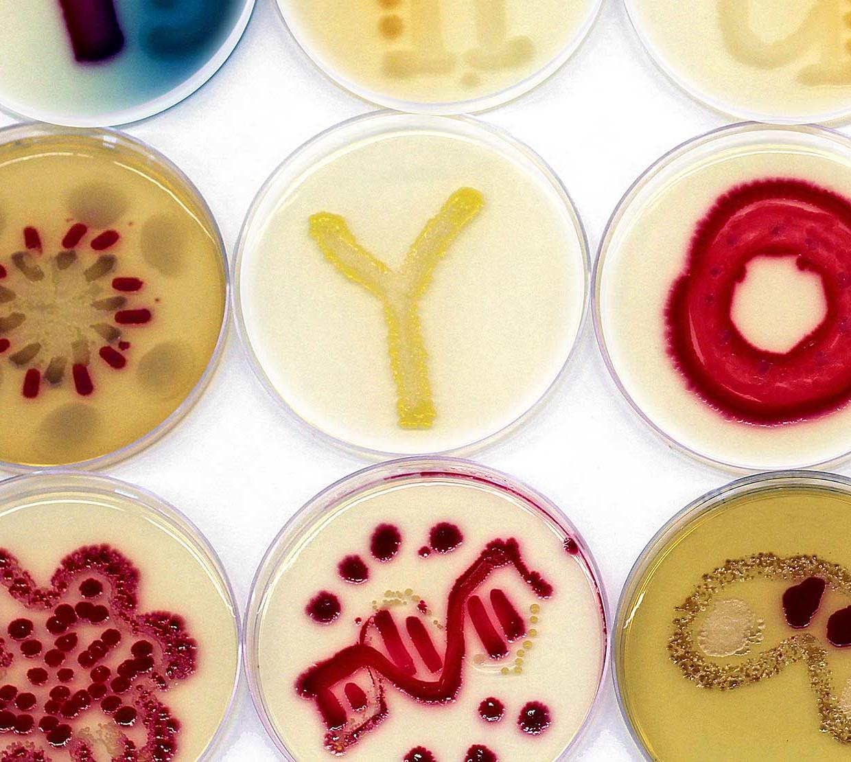 Petri dishes with micro-biome artwork