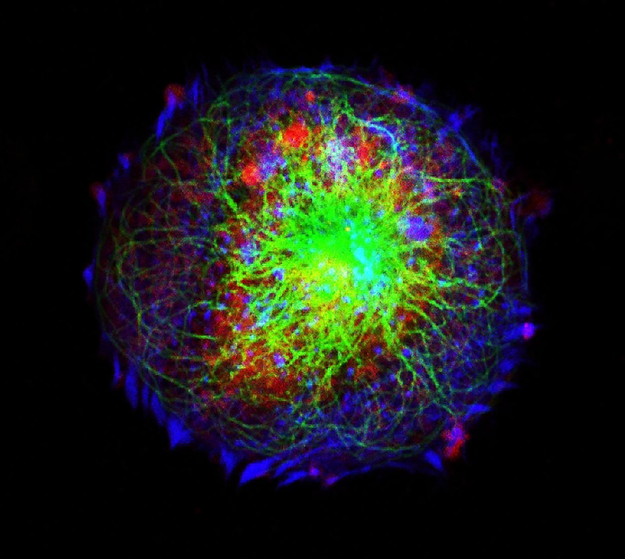 animated model of neuroblastoma cells