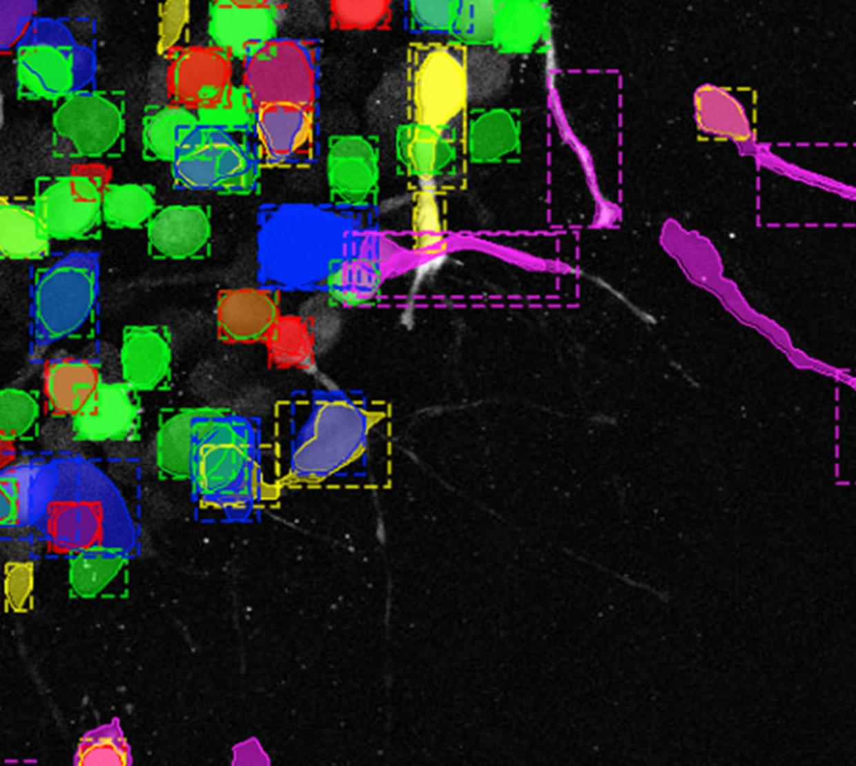 Digital image of cancer cells migrating.