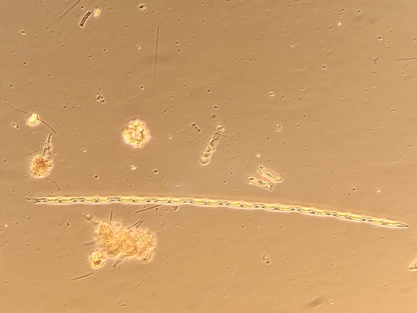 A yellow string of Pseudo-nitzschia sp. 10-cell chain under the microscope.