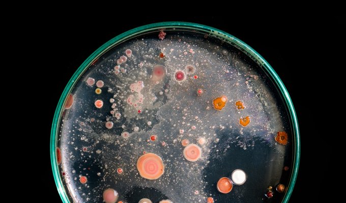 An overhead image of orange bacterial colonies growing on a petri dish